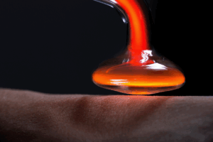 Therapie mit Kaltplasma